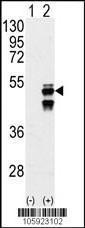 Anti-PPM1F Rabbit Polyclonal Antibody (FITC (Fluorescein))