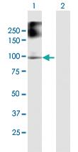 Anti-FANCB Mouse Polyclonal Antibody