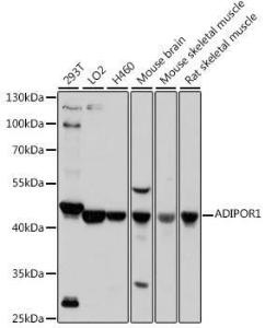 Western blot analysis of extracts of various cell lines, using Anti-ADIPOR1 Antibody (A307854) at 1:1,000 dilution