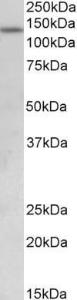 Anti-KDM2A Antibody (A84959) (0.5µg/ml) staining of Human Uterus lysate (35µg protein in RIPA buffer). Primary incubation was 1 hour. Detected by chemiluminescence.