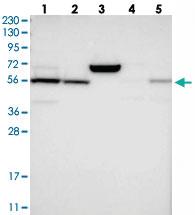 Anti-LPCAT1 Rabbit Polyclonal Antibody