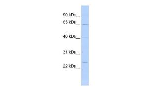 Anti-PLXNA4 Rabbit Polyclonal Antibody