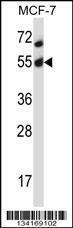 Anti-AKT2 Rabbit Polyclonal Antibody (FITC (Fluorescein Isothiocyanate))