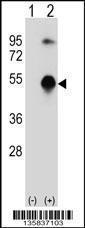 Anti-GATA3 Rabbit Polyclonal Antibody (AP (Alkaline Phosphatase))