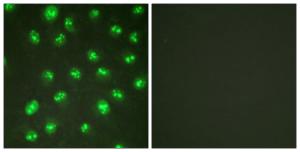 Immunofluorescence analysis of HUVEC cells using Anti-p57 Kip2 Antibody. The right hand panel represents a negative control, where the antibody was pre-incubated with the immunising peptide.