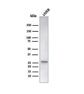 Anti-HSP27 antibody