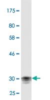 Anti-CDSN Mouse Monoclonal Antibody [clone: 5B4]