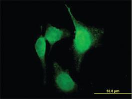 Anti-PTGS2 Mouse Polyclonal Antibody