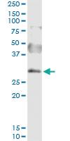 Anti-SNAI2 Polyclonal Antibody Pair