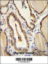 Anti-GUCY2D Rabbit Polyclonal Antibody (FITC (Fluorescein Isothiocyanate))