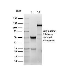 Antibody anti-HSP27 HSPB16490R 100 µg