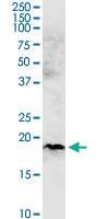 Anti-CHCHD4 Mouse Monoclonal Antibody [clone: 6C9]