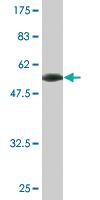 Anti-RHOXF2 Mouse Monoclonal Antibody [clone: 3C4]