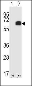 Anti-RIPK2 Rabbit Polyclonal Antibody (AP (Alkaline Phosphatase))