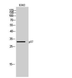 Western blot analysis of K562 cells using Anti-p57 Kip2 Antibody