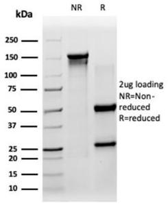 SDS-PAGE analysis of Anti-SIRT3 Antibody [PCRP-SIRT3-1C10] under non-reduced and reduced conditions; showing intact IgG and intact heavy and light chains, respectively SDS-PAGE analysis confirms the integrity and purity of the antibody