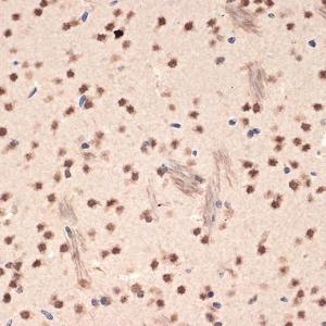 Immunohistochemistry analysis of paraffin-embedded mouse brain using Anti-EHMT2/G9A Antibody [ARC2470] (A305253) at a dilution of 1:100 (40X lens). Perform microwave antigen retrieval with 10 mM Tris/EDTA buffer pH 9.0 before commencing with IHC staining protocol