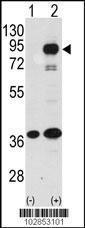 Anti-PROX1 Rabbit Polyclonal Antibody (AP (Alkaline Phosphatase))