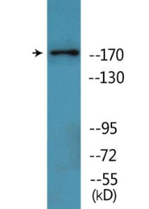 Western blot analysis of lysates from HepG2 cells treated with Ca2 + 40nM 30' using Anti-TOP2A (phospho Thr1343) Antibody