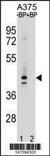 Anti-OR5AC2 Rabbit Polyclonal Antibody (APC (Allophycocyanin))