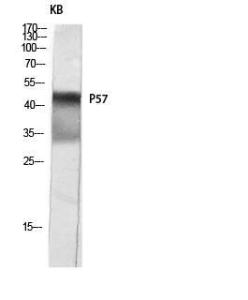 Western blot analysis of KB lysis using Anti-p57 Kip2 Antibody