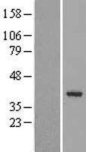 Anti-TLR6 Mouse Monoclonal Antibody [clone: 86B1153.2]