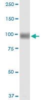 Anti-MME Rabbit Polyclonal Antibody