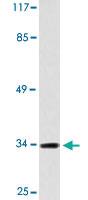 Anti-ACKR2 Rabbit Polyclonal Antibody