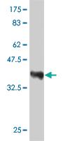 Anti-VAV1 Mouse Monoclonal Antibody [clone: 1A6]