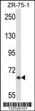 Anti-JPH2 Rabbit Polyclonal Antibody (APC (Allophycocyanin))