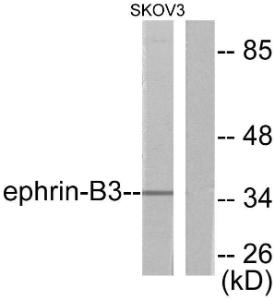 Western blot analysis of lysates from SKOV3 cells using Anti-EFNB3 Antibody The right hand lane represents a negative control, where the antibody is blocked by the immunising peptide