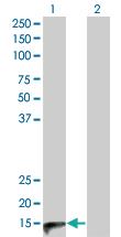 Anti-CALCA Mouse Monoclonal Antibody [clone: 4B10]