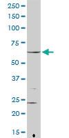 Anti-FANCG Rabbit Polyclonal Antibody