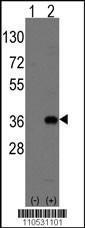 Anti-MSX2 Rabbit Polyclonal Antibody (FITC (Fluorescein Isothiocyanate))