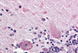 Anti-PPP2R3A Antibody (A83341) (5 µg/ml) staining of paraffin embedded Human Cerebellum. Steamed antigen retrieval with citrate buffer pH 6, AP-staining