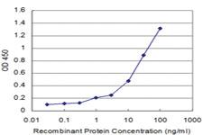 Anti-CALCA Mouse Monoclonal Antibody [clone: 4B10]