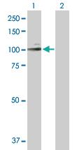 Anti-MME Rabbit Polyclonal Antibody