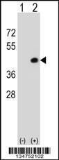 Anti-DAPK2 Rabbit Polyclonal Antibody (AP (Alkaline Phosphatase))