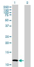 Anti-CALCB Mouse Polyclonal Antibody