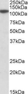 Anti-MTHFD1L Antibody (A84963) (01 µg/ml) staining of Human Cerebellum lysate (35 µg protein in RIPA buffer) Primary incubation was 1 hour Detected by chemiluminescence