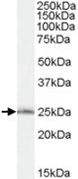 Anti-SAR1B Goat Polyclonal Antibody