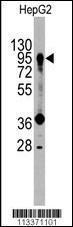 Anti-PROX1 Rabbit Polyclonal Antibody (AP (Alkaline Phosphatase))