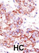 Anti-USP4 Rabbit Polyclonal Antibody (PE (Phycoerythrin))