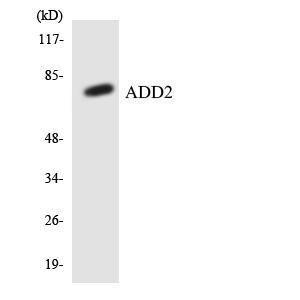 Western blot analysis of the lysates from HeLa cells using Anti-ADD2 Antibody