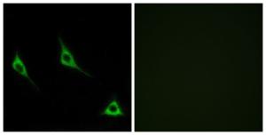 Immunofluorescence analysis of LOVO cells using Anti-OR51A7 Antibody. The right hand panel represents a negative control, where the Antibody was pre-incubated with the immunising peptide