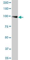 Anti-MME Rabbit Polyclonal Antibody