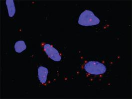 Anti-PDGFRB + STAT5A Antibody Pair