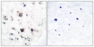 Immunohistochemical analysis of paraffin-embedded human brain tissue using Anti-EFNB3 Antibody The right hand panel represents a negative control, where the antibody was pre-incubated with the immunising peptide