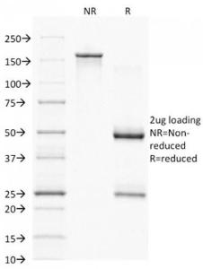 SDS-PAGE analysis of Anti-PAX7 Antibody [PAX7/1187] under non-reduced and reduced conditions; showing intact IgG and intact heavy and light chains, respectively SDS-PAGE analysis confirms the integrity and purity of the antibody