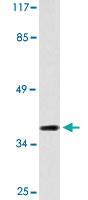 Anti-CYSLTR1 Rabbit Polyclonal Antibody